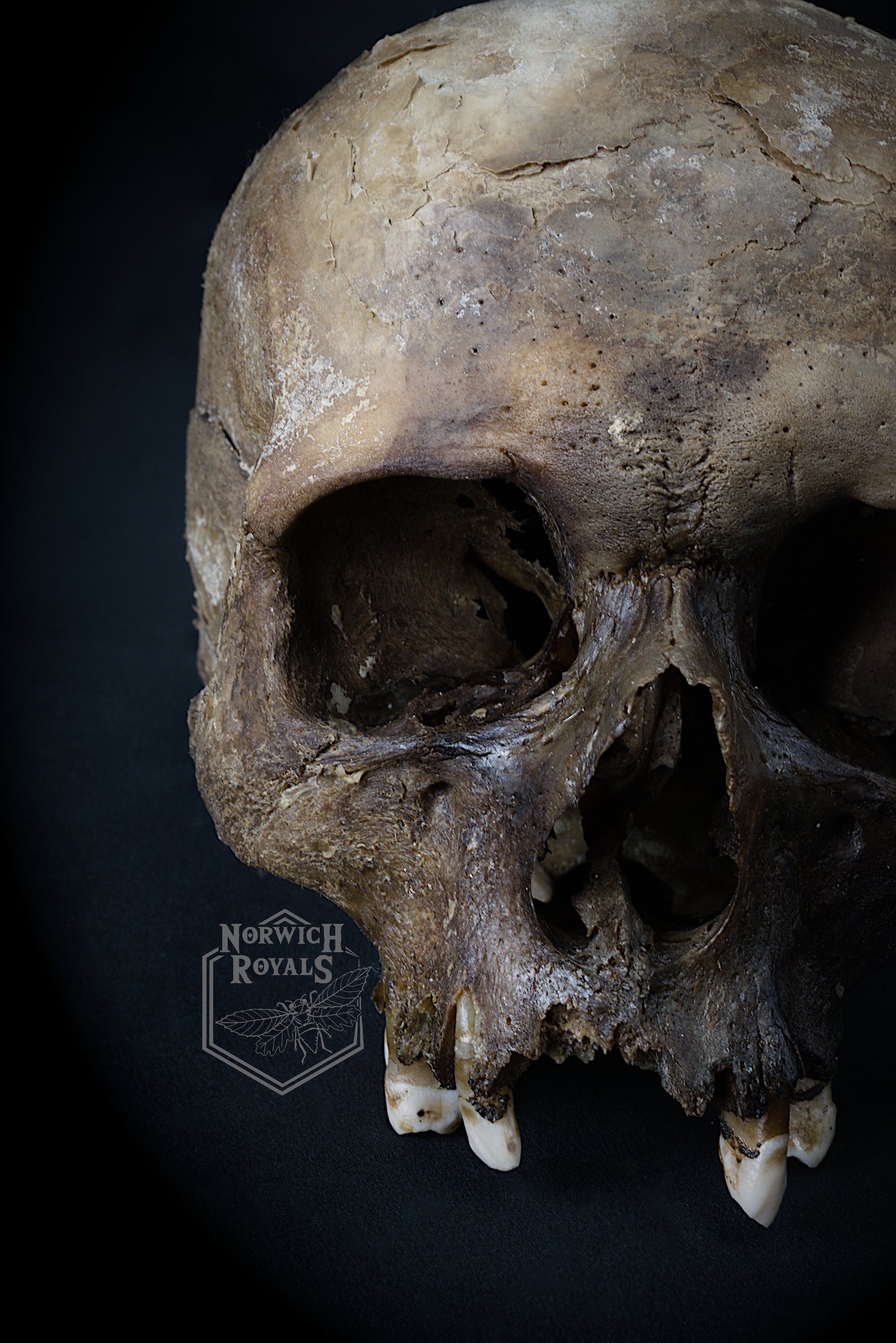 Human Skull